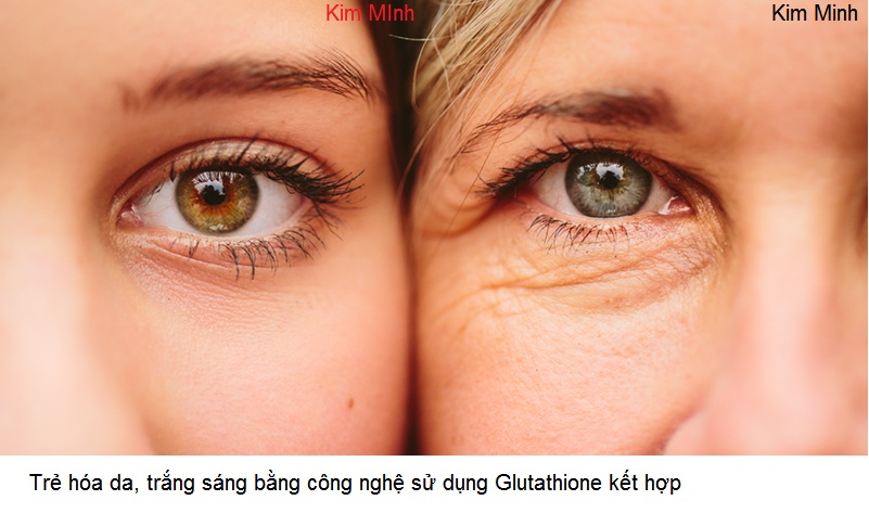 Cong nghe tiem trang glutathione la gi Kim Minh