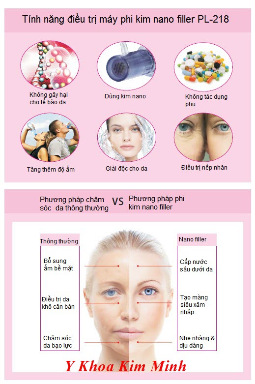 Tính năng điều trị nám và làm sáng trắng da bằng máy lăn kim nano filler PL218 - Y khoa Kim Minh