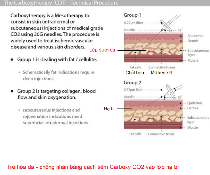 Cham soc da, tre hoa da bang lieu phap Carboxy CO2 CDT Y khoa Kim Minh 0933455388