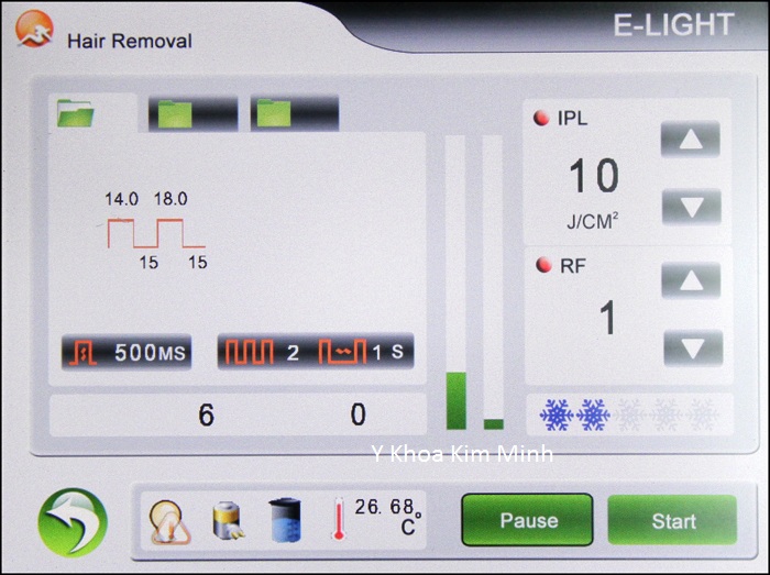 Máy triệt lông E-light đa năng KV-300 bán Y Khoa Kim Minh 13