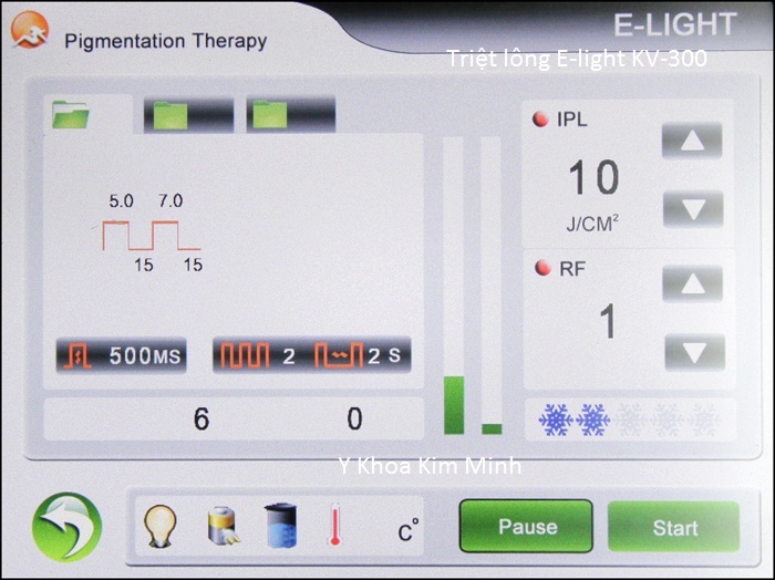 Máy triệt lông E-light đa năng KV-300 bán Y Khoa Kim Minh 18