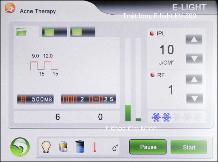 Máy triệt lông E light đa năng KV-300 bán Y Khoa Kim Minh 15