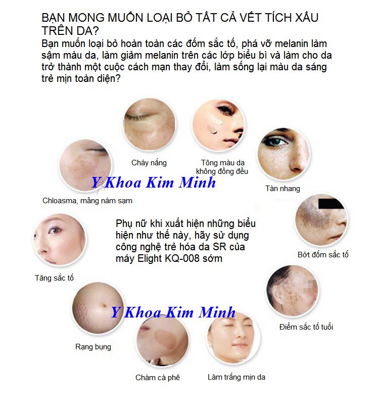 Tăng hiệu quả trẻ hóa da gấp 10 lần với Elight HR SR Magneto KQ-008 - Y Khoa Kim Minh Triệt lông trẻ hóa da công nghệ tiên tiến Magneto Elight HR SR KQ-008 - Y Khoa Kim Minh 0933455388