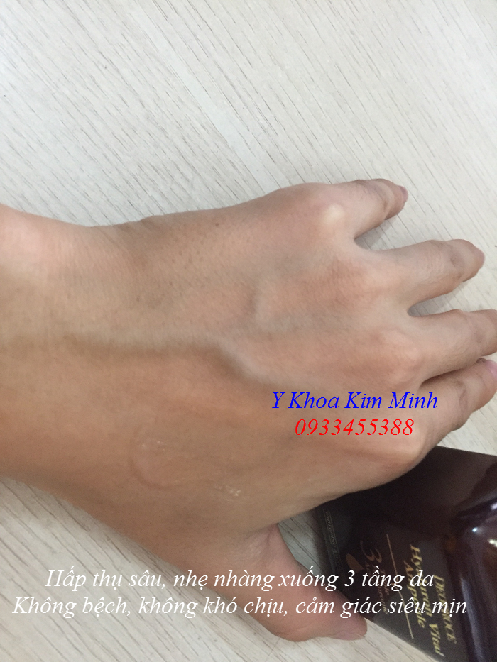 Kết quả trước và sau khi dùng huyết thanh Deoproce Hyaluron Vital Ampoule Hàn Quốc - Y khoa Kim Minh