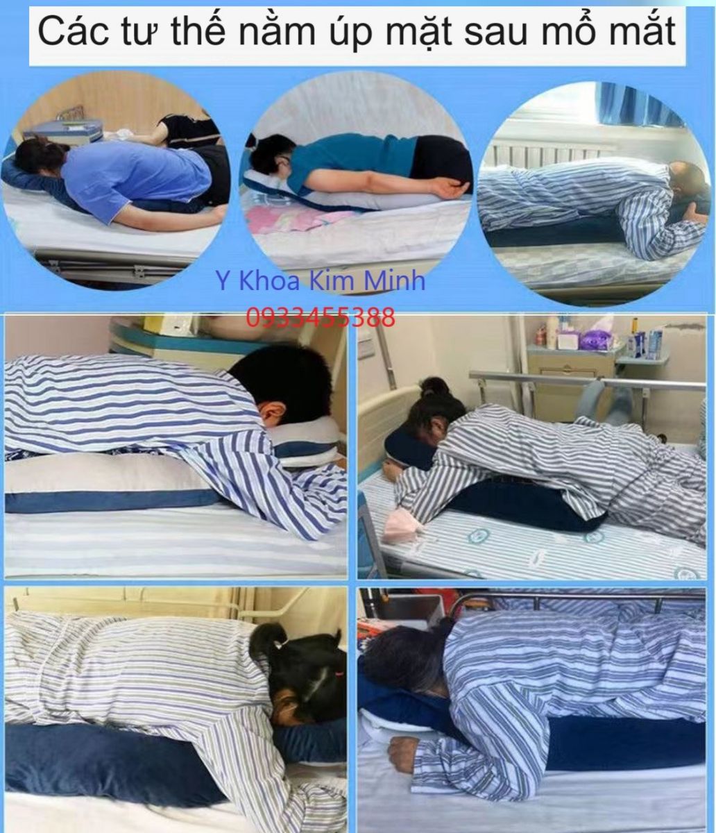 Tư thế nằm úp mặt khi ngủ sau khi phẫu thuật mổ mắt giác mạc