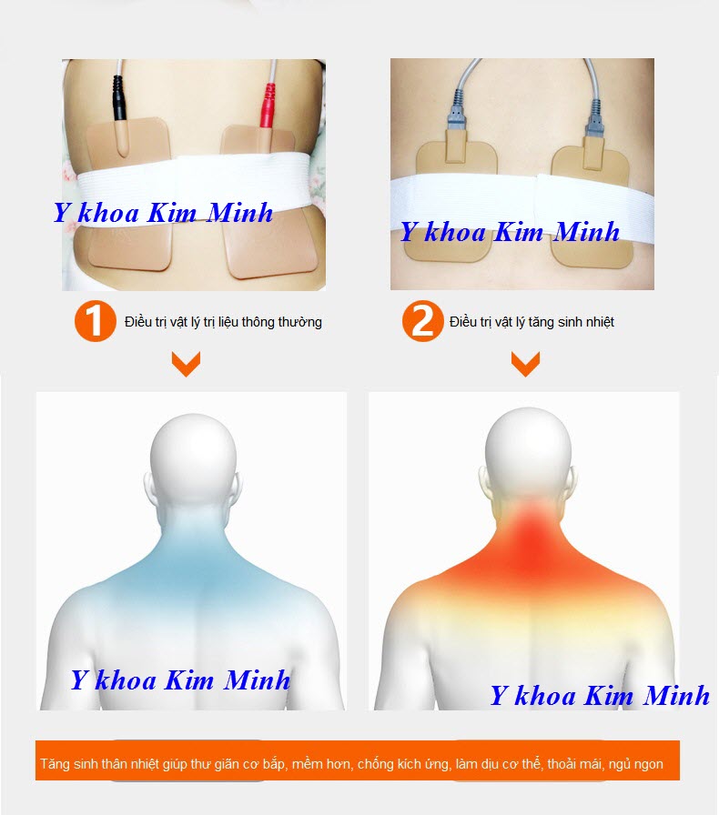 Ứng dụng điều trị bằng miếng dán điều trị trung tần BA2008-II - Y khoa Kim Minh