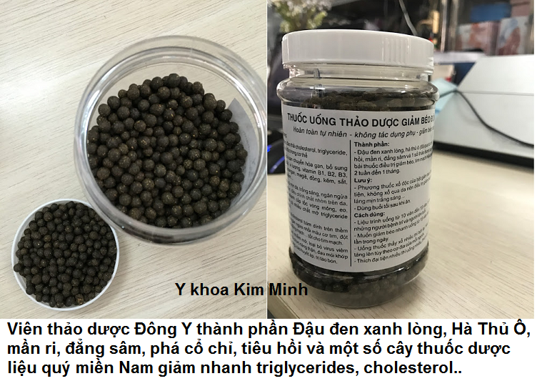 Vien giam beo dong y thao duoc dong y giam cholesterol, triglycerides, mo mau, tieu duong, ngua tai bien ung thu Y Khoa Kim Minh