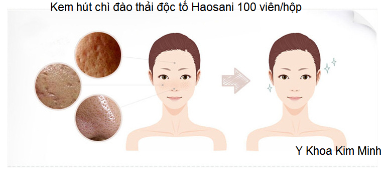 Vien thai chi hut doc to Haosani 100 vien Y Khoa Kim Minh