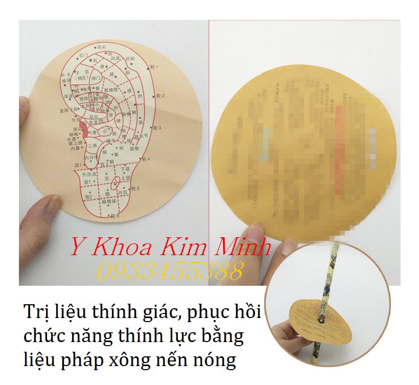 Xông nến thơm trị liệu thính giác, phục hồi chức năng