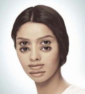 bệnh đôt quỵ, tai biến mạch máu não, xuất huyết não