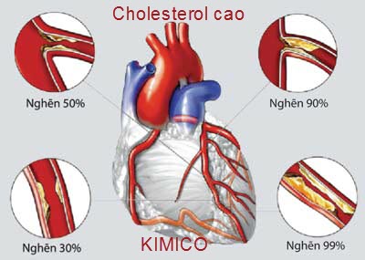 Máy đo huyết áp và nguyên nhân tăng huyết áp