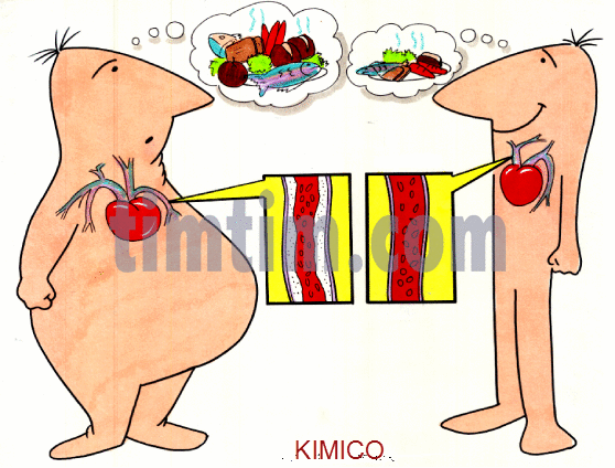 Bệnh xơ vữa động mạch xơ cứng động mạch