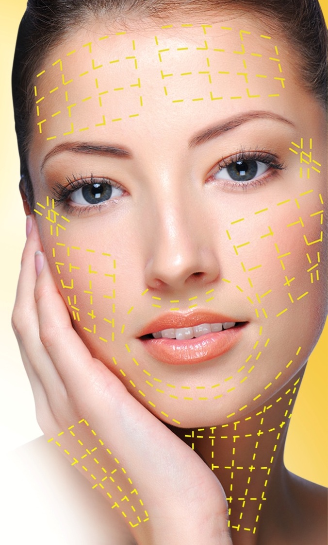 Căng da chỉ v&agrave;ng 4D Ultra V lift H&agrave;n Quốc Y Khoa Kim Minh