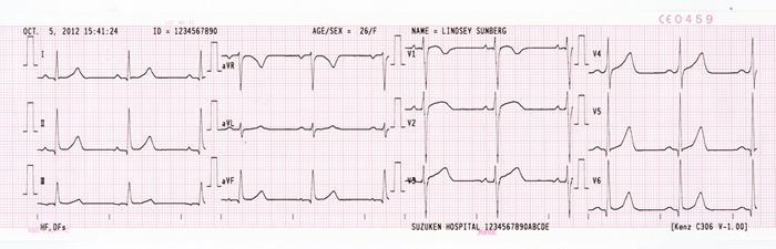 Giấy in máy điện tim suzuken Cardio 306
