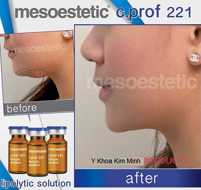 Chat chich tieu nong cam, phan giai mo giam beo lipolytic solution Y Khoa Kim Minh