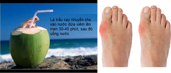 Chua benh gout bang la trau xay nhuyen voi nuoc dua xiem