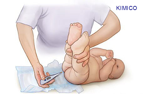 nhiệt kế điện tử đo trán Microlife FR1DL1