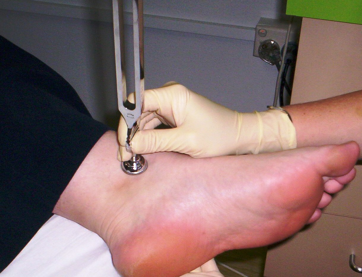 Kiểm tra cảm giác bằng âm thoa