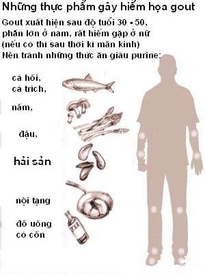 bệnh gut, chữa trị gout