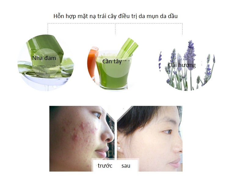 Máy làm mặt nạ trái cây trị mụn