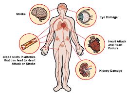 huyet ap, may do huyet ap