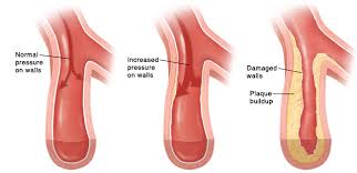 huyet ap, may do huyet ap