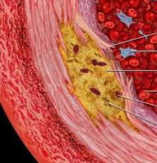 bệnh cao huyết &aacute;p, m&aacute;y đo huyết &aacute;p