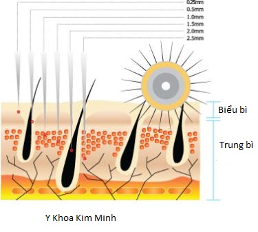Cay lan kim tay Dr Roller 192 kim Han quoc ban tai Y Khoa Kim Minh