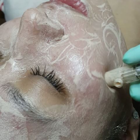 Lieu trinh cay phan nuoi da cong nghe Han quoc BB Covered Meso Whtie Y Khoa Kim Minh