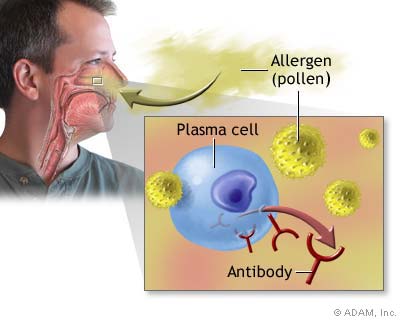 m&aacute;y trị vi&ecirc;m xoang, vi&ecirc;m mũi dị ứng medinoise Medisana Y khoa Kim Minh