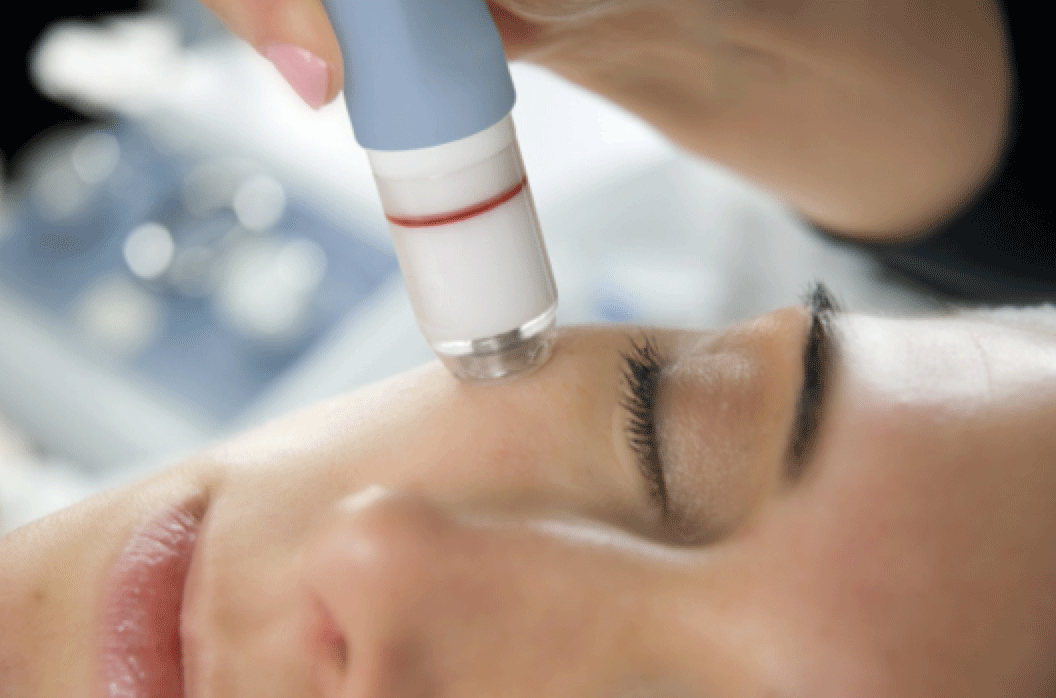 M&aacute;y c&agrave; da tẩy tế b&agrave;o chết Hydro microdermabrasion