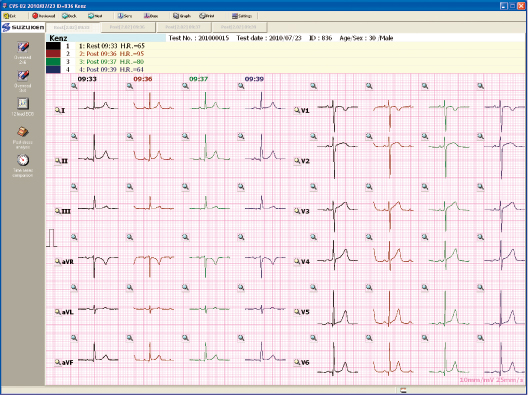 Giấy in máy điện tim 6 cần Suzuken Cardio 601