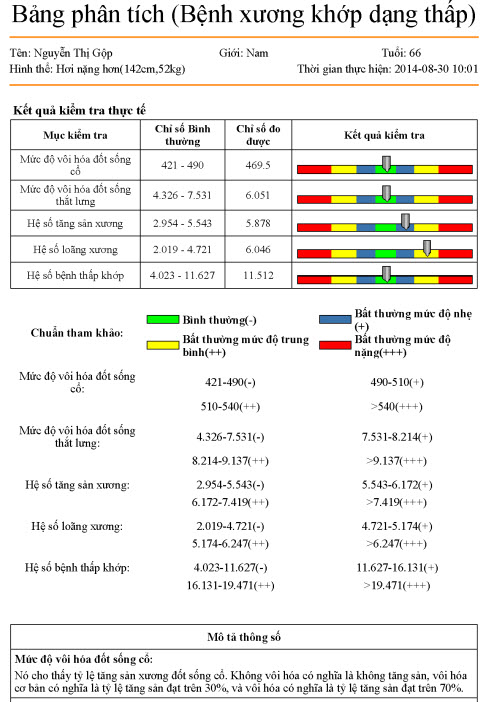 Máy phân tích bệnh loãng xương cơ thể KG01
