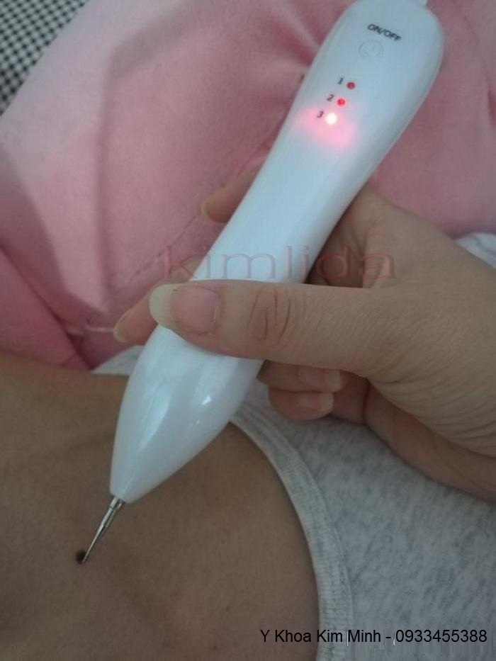 May quet xoa nam tan nhang mun thi do moi Y Khoa Kim Minh