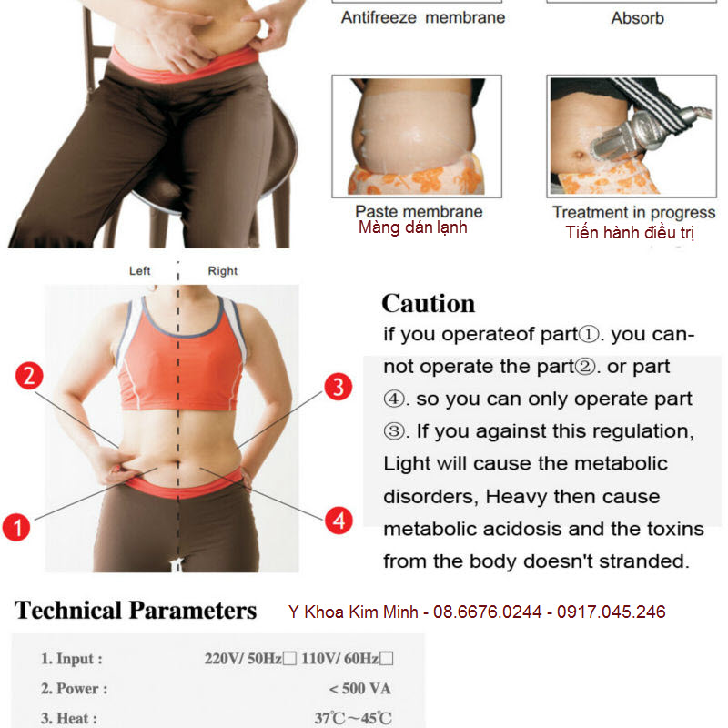 Giảm b&eacute;o quang đ&ocirc;ng ph&acirc;n giải mỡ cryolipolysis