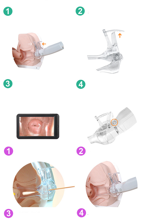 May kiem tra co tu cung Y Khoa Kim Minh