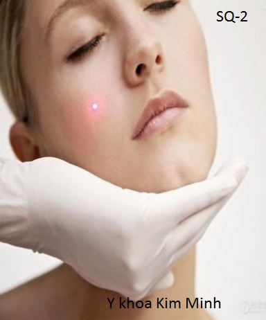 Máy laser xóa xăm trẻ hóa da công nghệ mới SQ-2