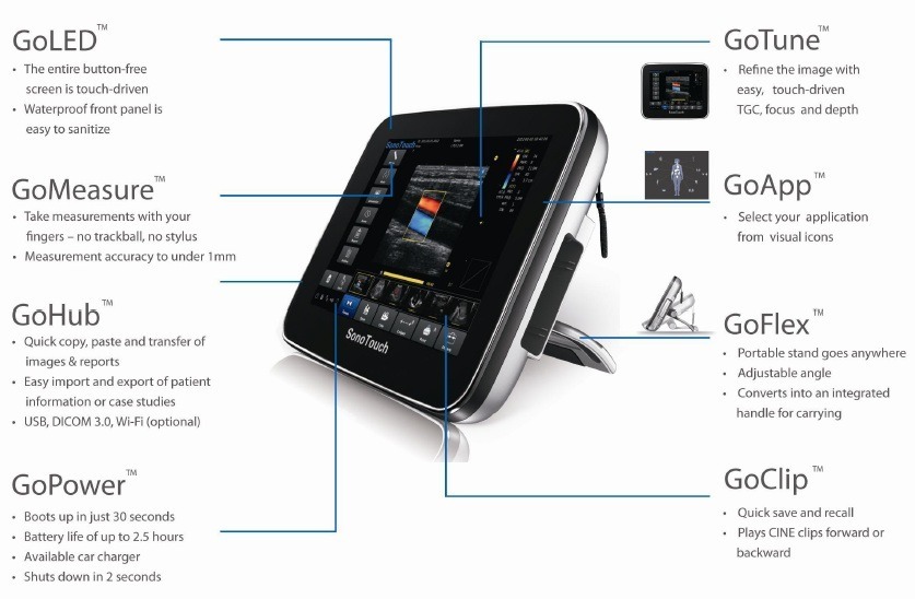 M&aacute;y si&ecirc;u &acirc;m m&agrave;u cầm tay Sono Touch