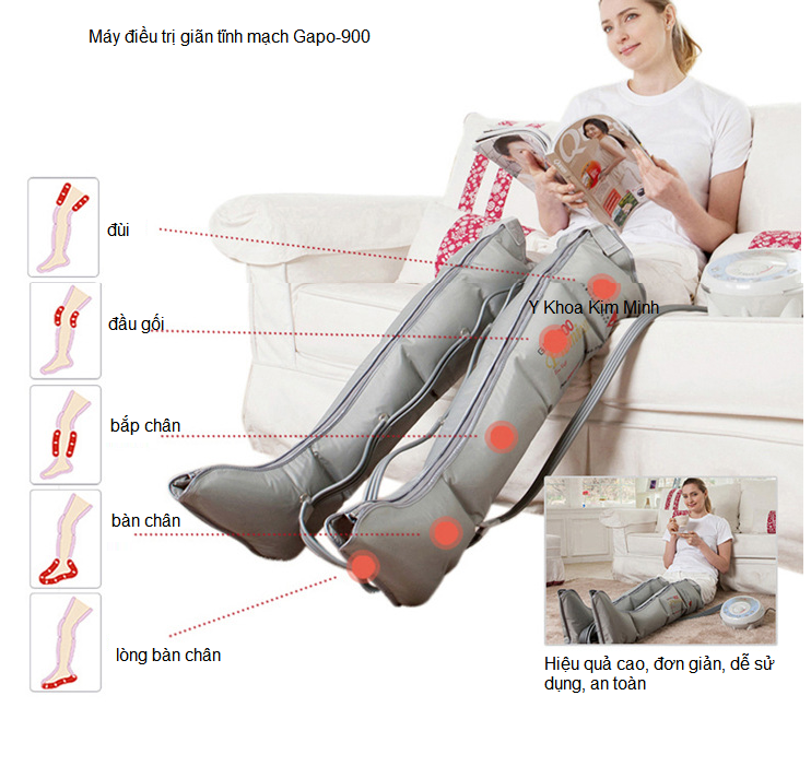 benh gian tinh mach la gi, ban may dieu tri gian tinh mach o dau, Y khoa Kim Minh