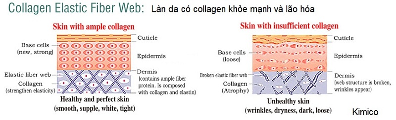 Dieu tri cham soc da collagen lao hoa Y khoa Kim Minh