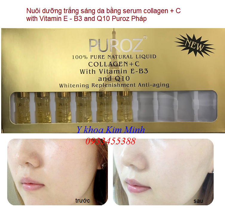 Nuôi dưỡng chạy C trắng da bằng huyết thanh serum Collagen Vitamin C E B3 Q10 Puroz Pháp - Y Khoa Kim Minh 0933455388