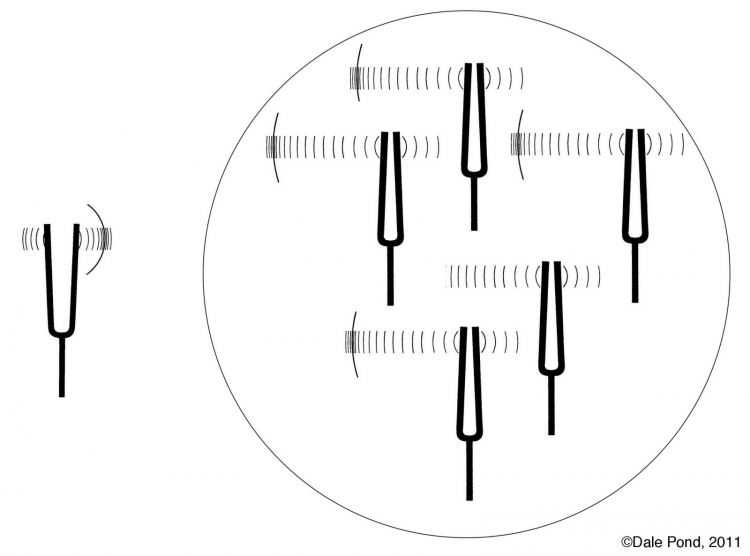 Sử dụng sóng âm thoa kiểm tra điếc thính giác