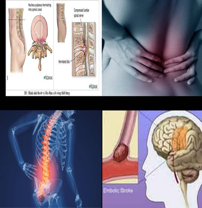 but massage dieu tri huyet dao