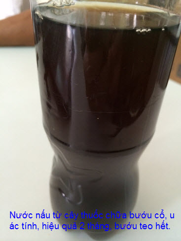 Thuốc chữa bệnh bướu độc, bướu cổ, u ác tính Y Khoa Kim Minh