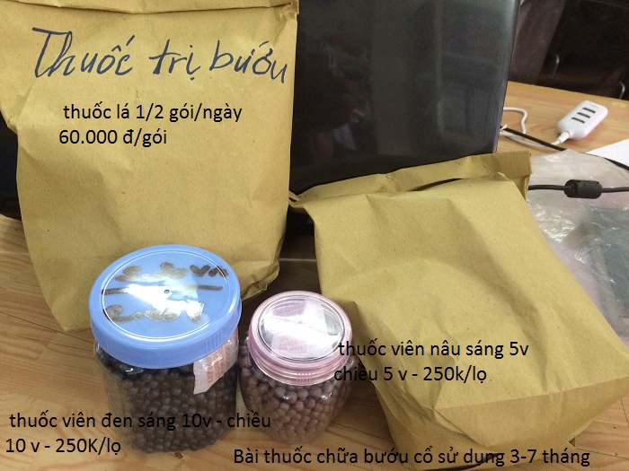 Thuốc chữa trị bướu cổ gia truyền có hiệu quả nhanh 3-7 tháng