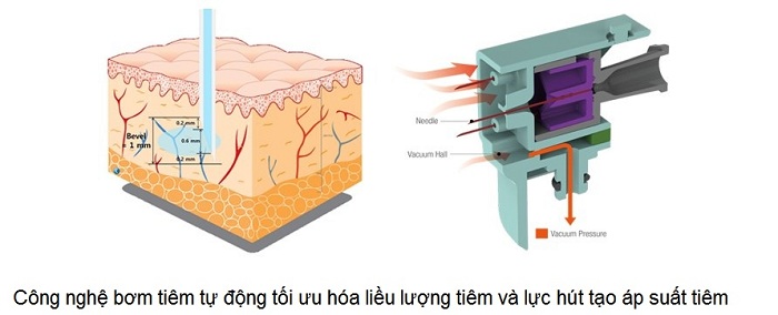 May bom tiem truyen my pham tu dong Vital Injector 2 Nhập khẩu Hàn Quốc Y Khoa Kim Minh
